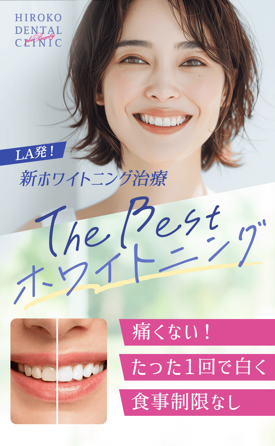 最新ホワイトニング治療　TheBestホワイトニング