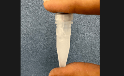 乳歯歯髄幹細胞培養上清液療法